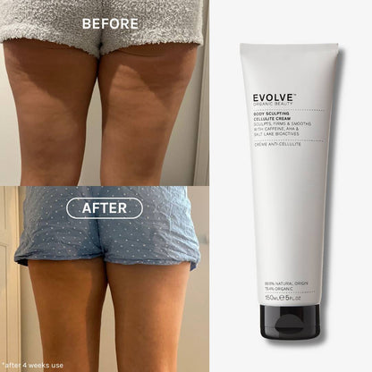 Before and after results of using Body sculpting cellulite cream. Visible reduction in cellulite afer 4  weeks of use