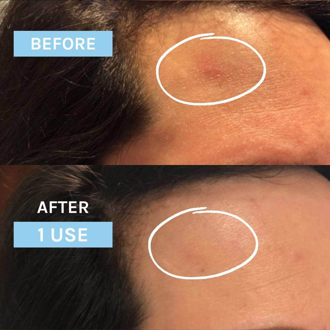 positive before and after of using blue velvet ceramide serum