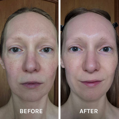 Evolve Organic Beauty Face Serum EGF + Collagen Renewal Booster